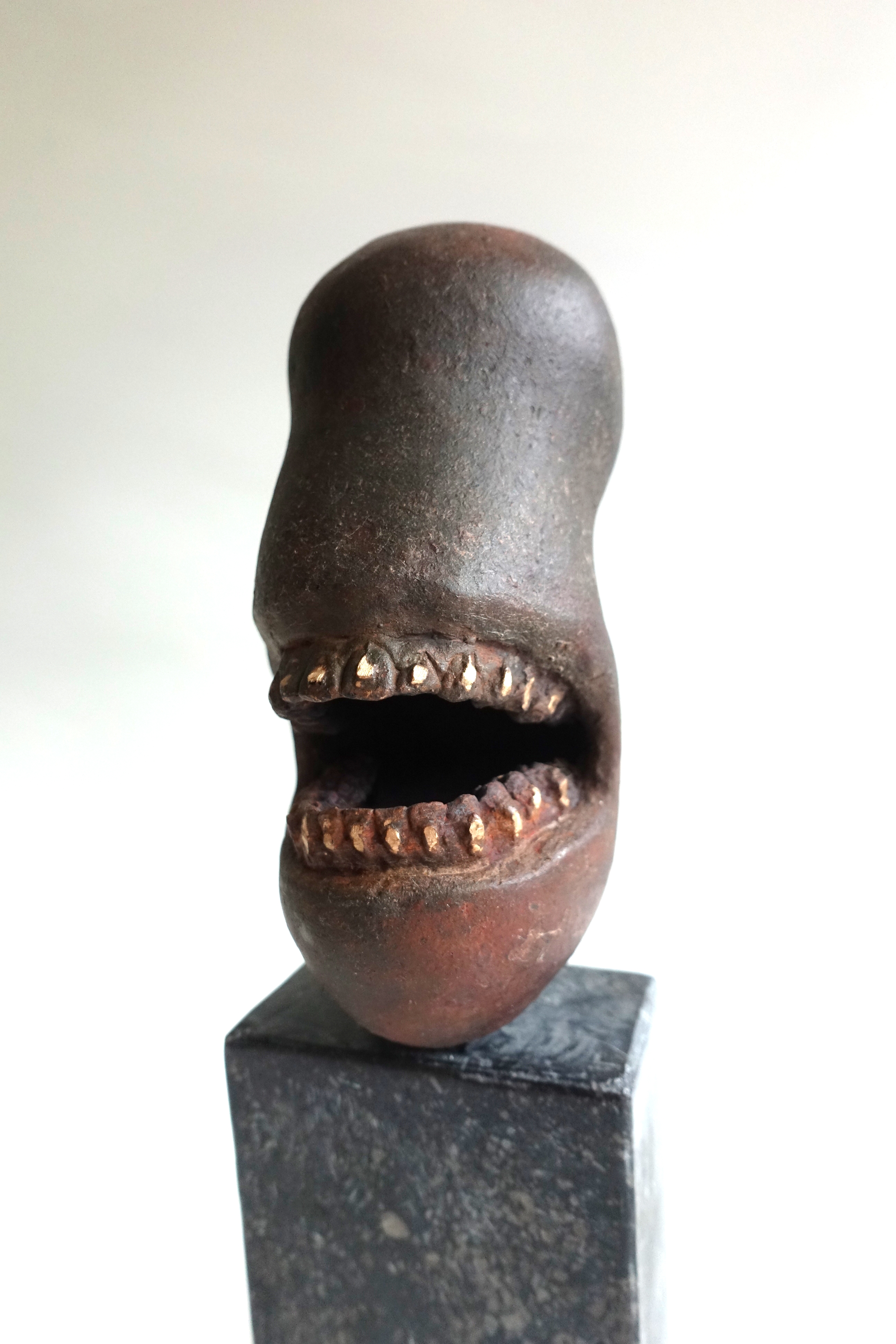 Deze afbeelding heeft een leeg alt-atribuut; de bestandsnaam is dsc02224-gebitskop-met-slotjes-1.jpg